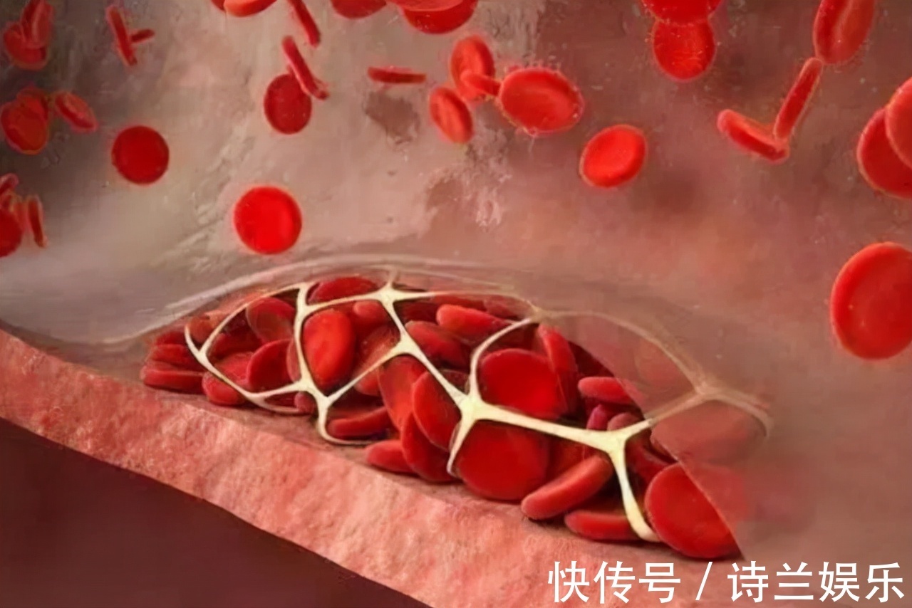 不饱和脂肪酸|甘油三酯偏高怎么办日常做好两件事，有助血脂恢复正常