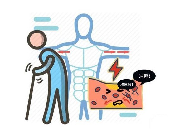 血管健康|血栓来访,身体遭殃!日常做好3件事,不和血栓打交道!