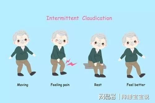 回事|间隙性跛行怎么回事？背后隐藏12种病，看看你是哪种？