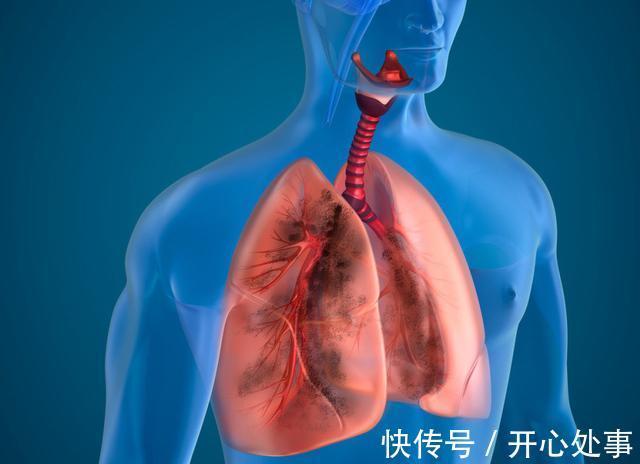 粗粮|患有肺结节的人，这种粗粮尽量少吃，或有助结节消散