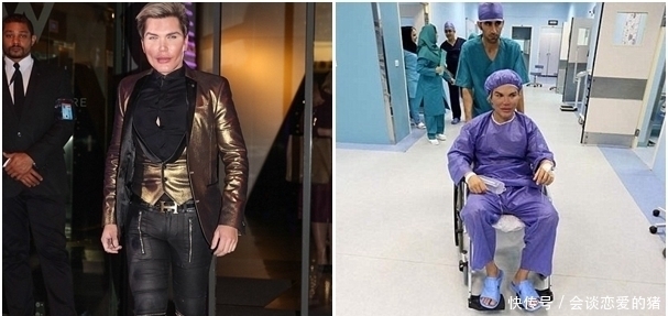 整得|33岁男子整容上瘾,花了百万巨资整容62次,鼻子被整得无法呼吸