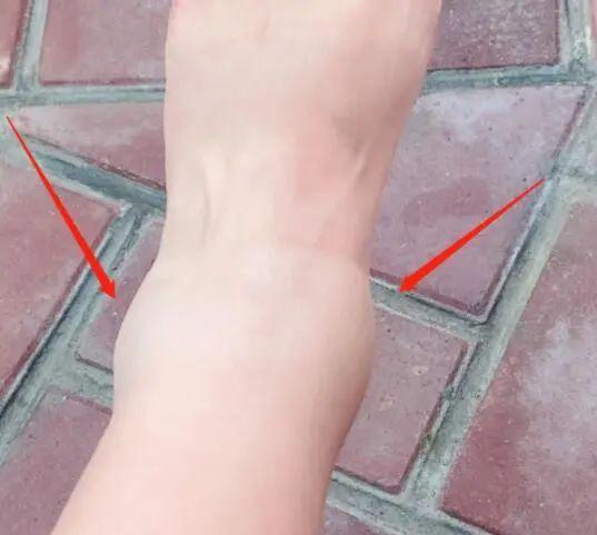 指南|孕期运动还能影响宝宝以后的健康?这份运动指南快收下!