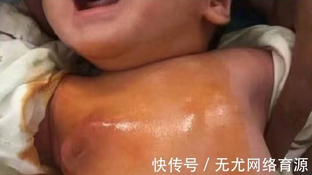 妈妈|出生十天的宝宝得“乳腺炎”, 医生训斥年轻妈妈太愚昧!