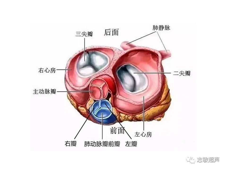 超声|肺动脉瓣周边异常血流的超声鉴别