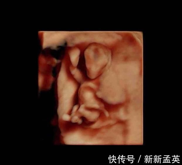 胚胎|胎儿从卵泡到性别形成,17张图片清晰诠释,男宝女宝看得很清楚