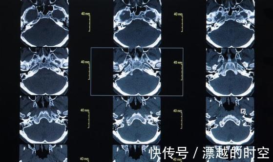 男孩|10岁男孩晕倒抢救无效死亡,医生都怪父母疏忽了一件事