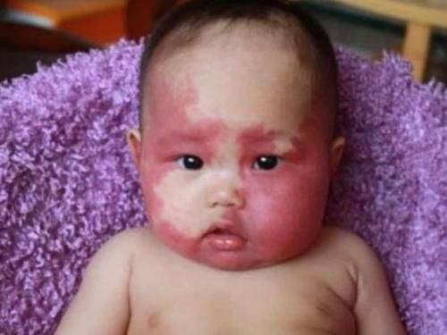 电器|女生怀孕后，4件事最好不做，避免宝宝身上会留下“胎记”