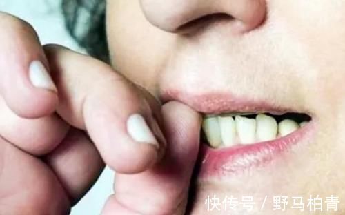 行为|孩子喜欢咬指甲,别认为是小事!这3个原因家长需了解,不要忽视