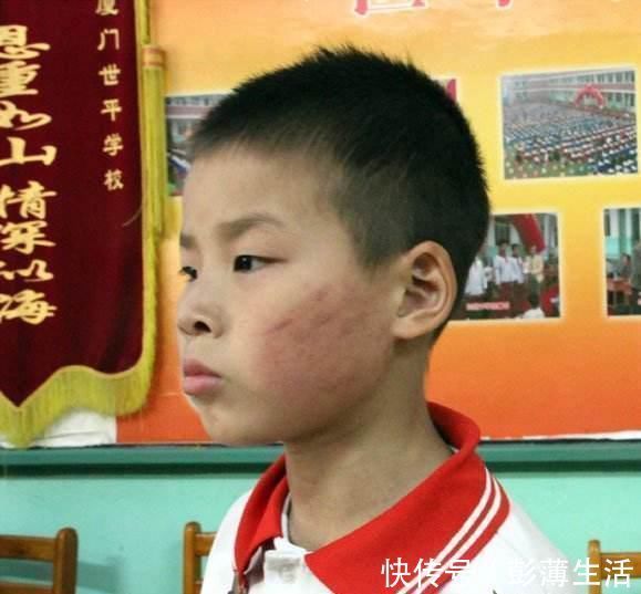 同学|上课被叫出来,9岁男生被同学家长拖拽殴打,施暴者还有一名孕妇