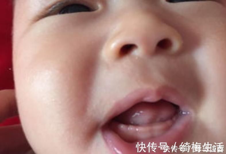 牙齿|婴幼儿什么时候长牙？这5个“信号”告诉妈妈：我长牙了