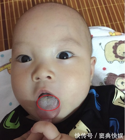 积食|如果宝宝发出7种表现,说明是身体“积食”了,家长别忽视