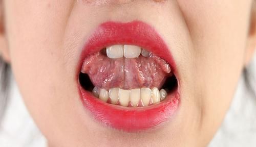 湿气也分种类内湿和外湿,湿寒和湿热,老中医帮你分的清清楚楚