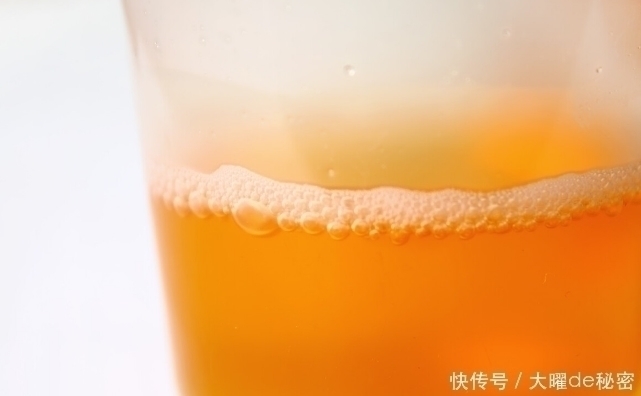 糖尿病肾病|尿毒症和肾功能衰竭跟糖尿病有什么关系?留意这4大症状