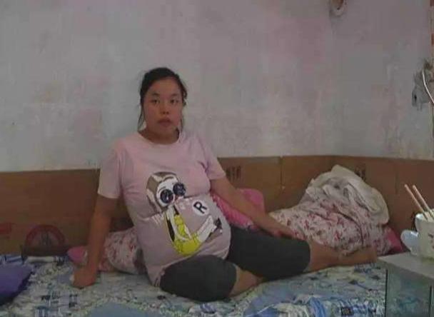 检查|儿媳妇去医院检查,发现孩子有“小尾巴”,婆婆听后不禁乐出声