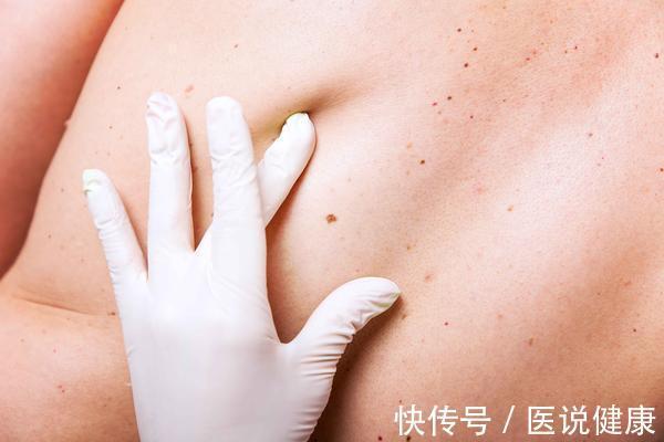 胆汁|肝不好时,身体会发出5种暗示,若你符合,要注意及时养肝