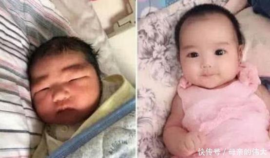 宝宝|高颜值父母却生出“丑宝宝”,一做亲子鉴定,宝爸叹气凑合养吧