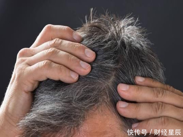 治疗|肝脏变硬,头部会频繁出现3个“极端”,早发现早治疗