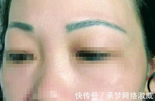 医生|为什么医生不提倡女生纹眉?内行人道出其中缘由,幸好没跟风