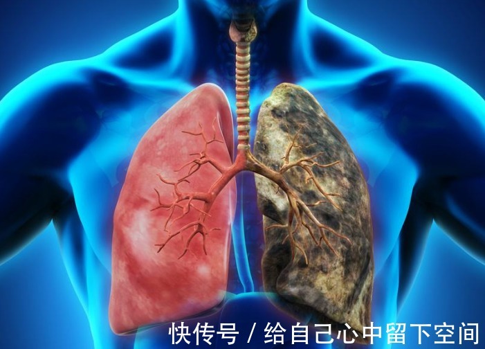 恶性肿瘤|患癌后,身体发出的第一个“信号”会是什么呢