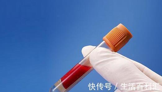 血脂|得了高血脂怎么办？专家强调：别担心，常吃5种食物血脂会更安全