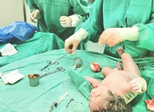 生娃|生娃前要知道的8件事,医生不会告诉你,但孕妈有必要了解