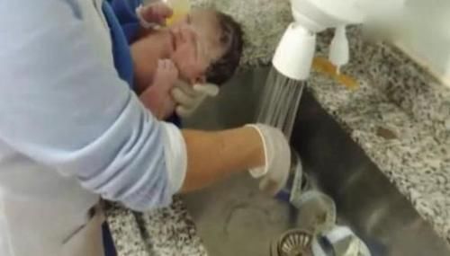 嫌弃|“黑脸宝宝”被亲妈嫌弃，护士却夸好看，2个月后高颜值逆袭