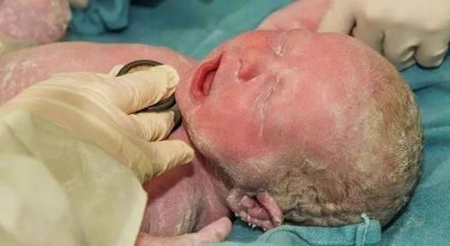 宝妈|产妇生下宝宝，看了一眼孩子大喊想要扔出去，令医生护士面面相觑