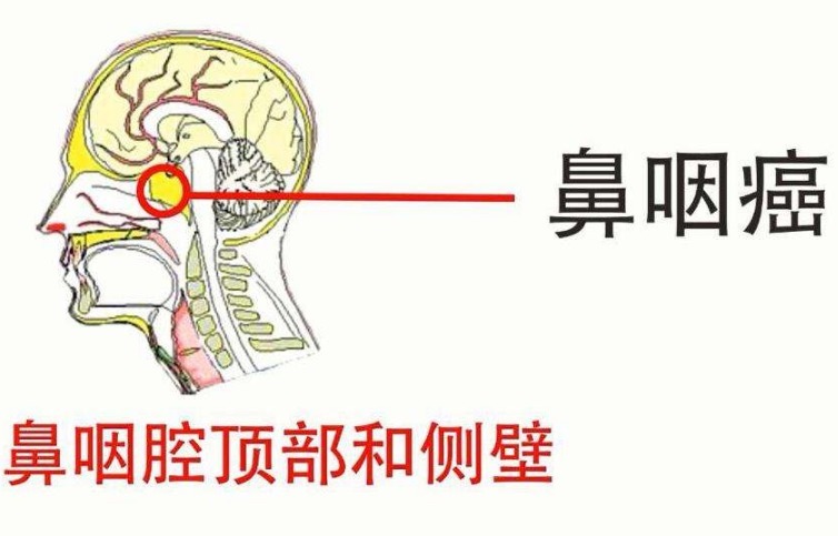 四大名补|送给癌症患者们的“四大名补”食疗方,这才是正确的抗癌方式