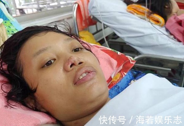 产妇|女子分娩1个月后被截去四肢,医生称是哺乳不当造成的