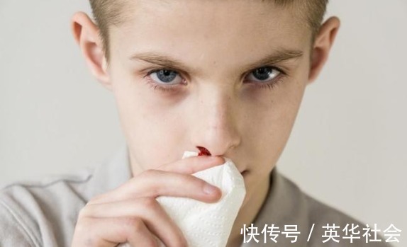 高血压|血压高的人，身体若有''1麻1红1疼''，尽早就医，警惕脑出血