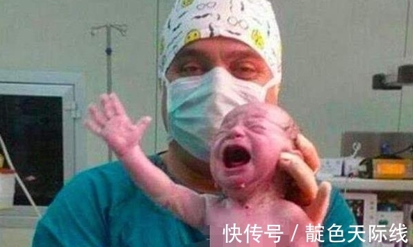 脐带|宝宝刚刚生下,医生要剪脐带时,宝宝的动作,让医生出了一身冷汗