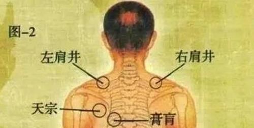  寒气|颈肩出现问题，久治不断根，其实是此处“寒气”没有化解