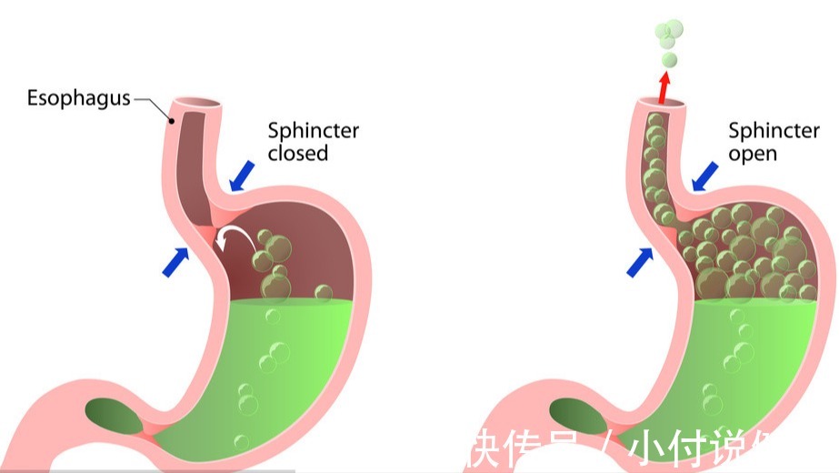 结石|别再把消化不良当胃病！或许是胆囊不好了，听听医生怎么说