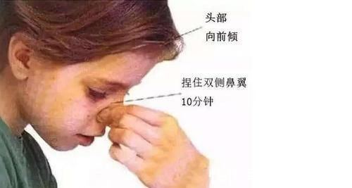 压迫止血法|宝宝容易流鼻血,父母不要再用纸巾塞鼻孔了,用其它的方法止血