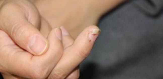 竖中指|肝好不好,“竖中指”就知道?如果没3个信号,肝脏还算不错!