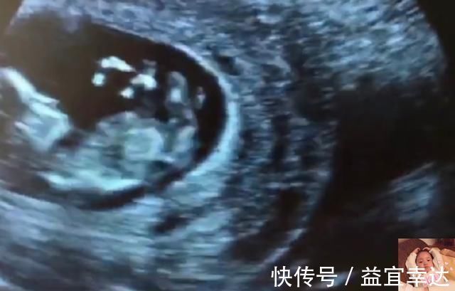 胎儿|除了睡觉,胎儿如何每天在肚子里都干啥宝宝小日子开心到飞起