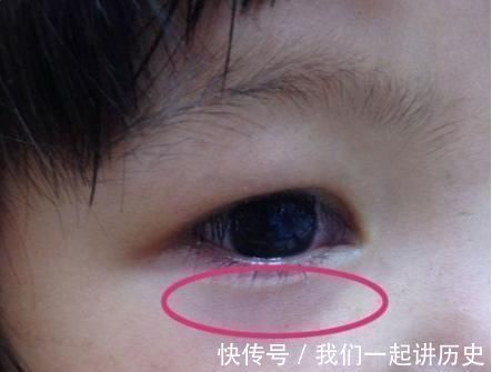 脾胃|孩子积食,脾胃虚,眼睛会说话,学会观察,宝宝积食早发现