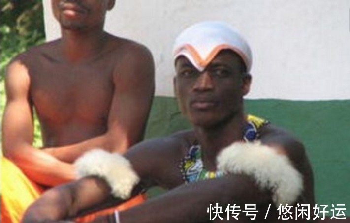 龟壳|奇闻:男孩背上长龟壳,父亲要扔掉,治疗后成这个模样