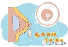 乳腺癌|【百年协和讲堂】乳房出现肿块？发红发热？乳头溢液？酒窝征？…有可能是乳腺癌！