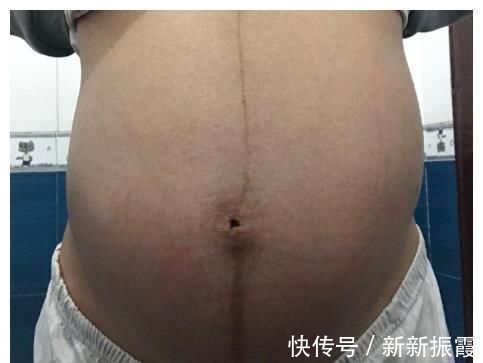 胎儿|“看你都胖啥样了,胎动能出现吗”太胖会影响胎动吗