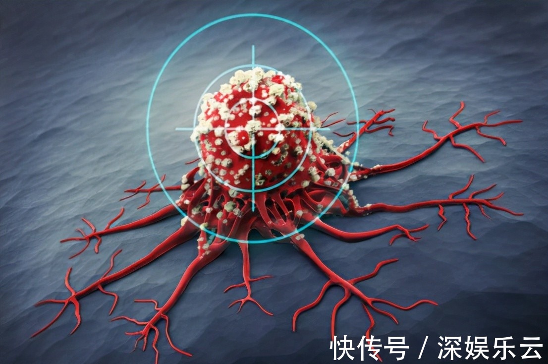 治疗|什么病易转化为癌症本文一口气说了6个常见病,你知道几个