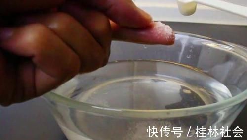 502胶水|3岁男童误将502胶当滴眼液,幸好妈妈及时处理,医生也为她点赞