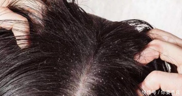 女生“洗头”常犯这3个错误,怪不得头发“越洗越油”,难怪异性缘为0