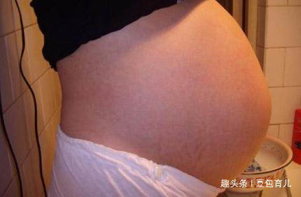 小知识|孕妈怀上双胞胎,全家兴高采烈,检查后医生却说那不是孩子!