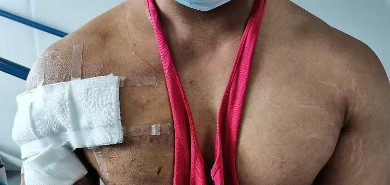 李劼若|健身教练卧举380斤失败胸大肌被生生撕脱