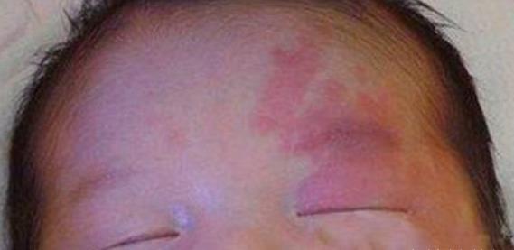 化学物质|胎儿自带“记号”,与孕妈错误行为有关,孕妈的放纵终由孩子买单