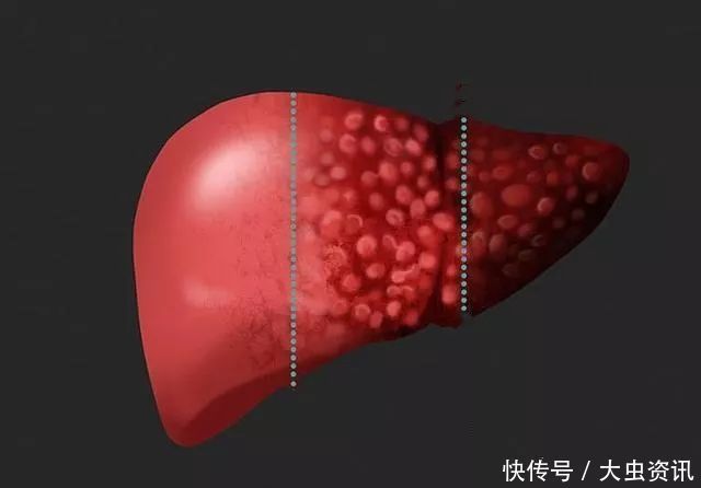 代茶饮|身体有6个表现，肝部已变“脏”，一个不占，恭喜，肝还很干净