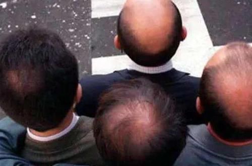 肾很好的男人,脸上无3个坏现象,若你1个都无,肾脏或许很健康