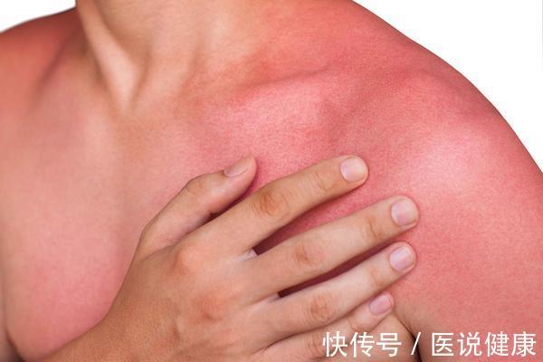 护肤品|皱纹是衰老的先行军,主要与这4大原因有关,教你3招减少皱纹