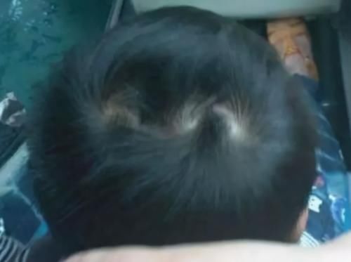 知晓|娃头上“一个旋”和“二个旋”有何区别?影响孩子性格,应知晓